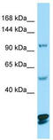 Catenin Delta 2 antibody, TA338276, Origene, Western Blot image 
