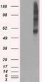 Synaptic vesicular amine transporter antibody, LS-C784285, Lifespan Biosciences, Western Blot image 