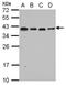Ribosomal Protein L6 antibody, GTX114913, GeneTex, Western Blot image 