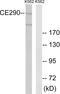 Centrosomal protein of 290 kDa antibody, LS-B9714, Lifespan Biosciences, Western Blot image 