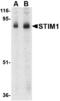 Stromal Interaction Molecule 1 antibody, MBS150530, MyBioSource, Western Blot image 