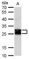 Crystallin Beta A1 antibody, GTX109207, GeneTex, Western Blot image 
