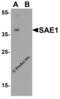SUMO1 Activating Enzyme Subunit 1 antibody, 5749, ProSci Inc, Western Blot image 