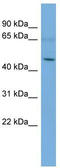 Ankyrin Repeat And SOCS Box Containing 3 antibody, TA344629, Origene, Western Blot image 
