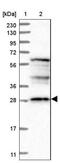 D-Aspartate Oxidase antibody, NBP1-85884, Novus Biologicals, Western Blot image 