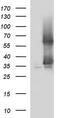 Secretory Carrier Membrane Protein 2 antibody, MA5-26296, Invitrogen Antibodies, Western Blot image 