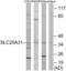 Solute Carrier Family 25 Member 31 antibody, LS-C119699, Lifespan Biosciences, Western Blot image 