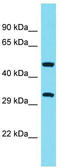 Abhydrolase Domain Containing 10 antibody, TA330680, Origene, Western Blot image 