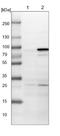 Poly(ADP-Ribose) Polymerase Family Member 6 antibody, NBP1-87333, Novus Biologicals, Western Blot image 