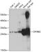 Crystallin Beta B2 antibody, GTX17574, GeneTex, Western Blot image 