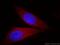 Akt antibody, 60203-1-Ig, Proteintech Group, Immunofluorescence image 