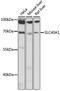 Slc39a1 antibody, 15-774, ProSci, Western Blot image 