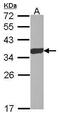 Esterase D antibody, PA5-30020, Invitrogen Antibodies, Western Blot image 