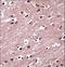 Nuclear receptor ROR-beta antibody, LS-C162679, Lifespan Biosciences, Immunohistochemistry paraffin image 