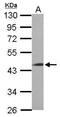 Leucine Rich Repeat Containing 2 antibody, PA5-30814, Invitrogen Antibodies, Western Blot image 