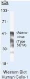 Adenovirus antibody, MA5-11349, Invitrogen Antibodies, Western Blot image 