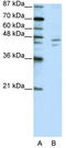 Zinc Finger Protein 419 antibody, TA345395, Origene, Western Blot image 