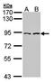 Alpha-catulin antibody, orb69937, Biorbyt, Western Blot image 