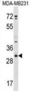 Protein IV antibody, abx029672, Abbexa, Western Blot image 