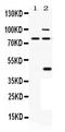 Proprotein Convertase Subtilisin/Kexin Type 6 antibody, PB9769, Boster Biological Technology, Western Blot image 