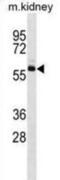 Sprouty Related EVH1 Domain Containing 1 antibody, abx025403, Abbexa, Western Blot image 