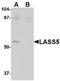 Ceramide Synthase 5 antibody, TA306609, Origene, Western Blot image 