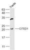 Cbp/p300-interacting transactivator 1 antibody, GTX00820, GeneTex, Western Blot image 