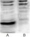 Pan Acetylated-Lysine  antibody, 251117, Abbiotec, Western Blot image 