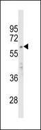 Apurinic/Apyrimidinic Endodeoxyribonuclease 2 antibody, LS-C156401, Lifespan Biosciences, Western Blot image 