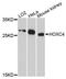 Homeobox C4 antibody, A8986, ABclonal Technology, Western Blot image 