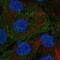 Discs Large MAGUK Scaffold Protein 5 antibody, NBP2-55619, Novus Biologicals, Immunocytochemistry image 