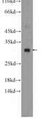 Endoplasmic reticulum resident protein 29 antibody, 24344-1-AP, Proteintech Group, Western Blot image 