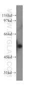 Fascin Actin-Bundling Protein 3 antibody, 13536-1-AP, Proteintech Group, Western Blot image 