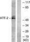CREB2 antibody, TA316503, Origene, Western Blot image 
