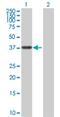 Aldehyde Dehydrogenase 3 Family Member B2 antibody, H00000222-D01P, Novus Biologicals, Western Blot image 