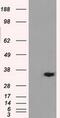 Alcohol dehydrogenase [NADP+] antibody, MA5-25008, Invitrogen Antibodies, Western Blot image 