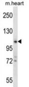Zinc Finger CCHC-Type Containing 14 antibody, abx027520, Abbexa, Western Blot image 