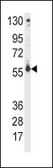 Cytochrome P450 Family 2 Subfamily C Member 9 antibody, 63-265, ProSci, Western Blot image 