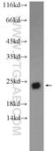 Chromosome 5 Open Reading Frame 24 antibody, 24319-1-AP, Proteintech Group, Western Blot image 