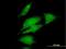 Diacylglycerol kinase alpha antibody, H00001606-B01P, Novus Biologicals, Immunocytochemistry image 