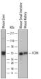 Fc Fragment Of IgG Receptor And Transporter antibody, PA5-47871, Invitrogen Antibodies, Western Blot image 