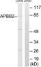 Amyloid beta A4 precursor protein-binding family B member 2 antibody, TA313455, Origene, Western Blot image 