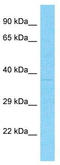 E3 ubiquitin-protein ligase MARCH5 antibody, TA329867, Origene, Western Blot image 
