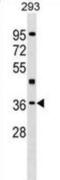 Hepatic leukemia factor antibody, abx029514, Abbexa, Western Blot image 