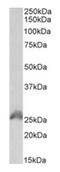 Homeobox B6 antibody, orb176719, Biorbyt, Western Blot image 