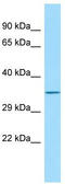 Family With Sequence Similarity 49 Member B antibody, TA331906, Origene, Western Blot image 