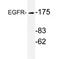 EGFR antibody, AP20708PU-N, Origene, Western Blot image 