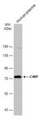 Complement Component 4 Binding Protein Alpha antibody, GTX130821, GeneTex, Western Blot image 