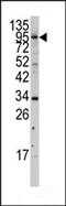 Myosin Light Chain Kinase 3 antibody, MBS9203201, MyBioSource, Western Blot image 