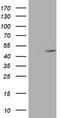 1-Acylglycerol-3-Phosphate O-Acyltransferase 5 antibody, TA504140, Origene, Western Blot image 